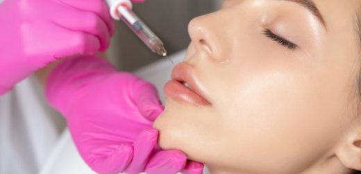 Should I Consult My Dentist Before Lip Botox? 